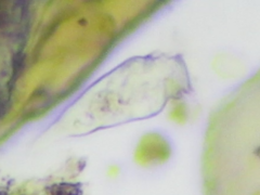 Sessilida