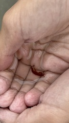Eumalacostraca