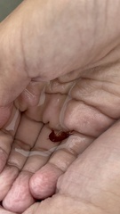 Eumalacostraca