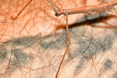 Pachymorphini