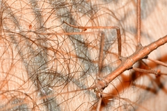 Pachymorphini