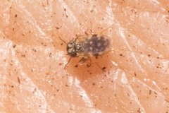 Liposcelididae