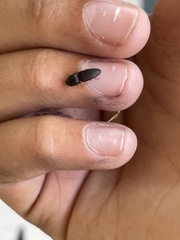 Heteroderes amplicollis