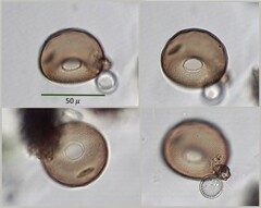 Arcella hemisphaerica