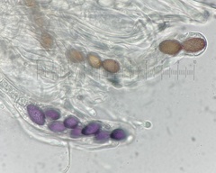 Ascobolus aglaosporus