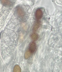Ascobolus aglaosporus