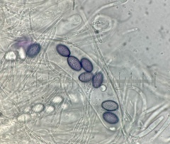 Ascobolus aglaosporus