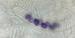 Ascobolus aglaosporus