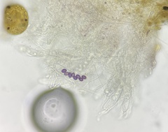 Ascobolus aglaosporus