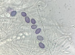 Ascobolus aglaosporus
