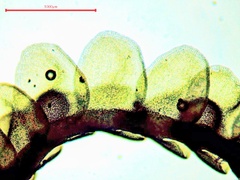 Odontoschisma sphagni