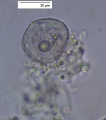 Protozoa