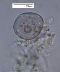 Protozoa
