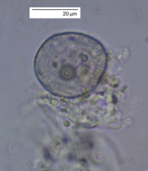 Protozoa