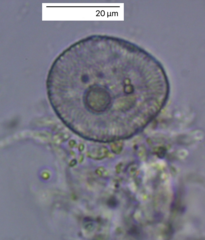 Protozoa