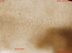 Adelphella
