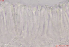 Orbilia luteorubella