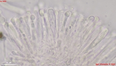 Orbilia luteorubella