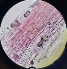 Sphagnum capillifolium