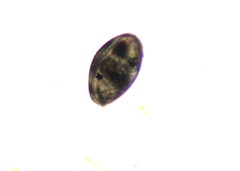 Ostracoda