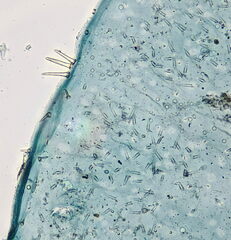 Parthenolecanium rufulum