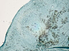 Parthenolecanium rufulum