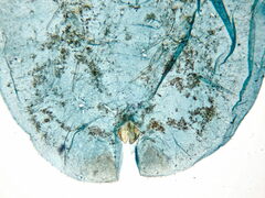 Parthenolecanium rufulum