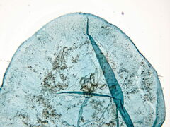 Parthenolecanium rufulum