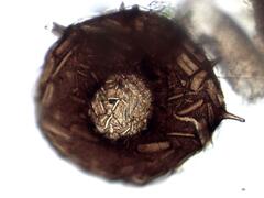 Centropyxis discoides