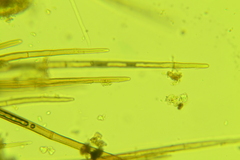 Trichophaea pseudogregaria