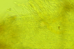 Trichophaea pseudogregaria