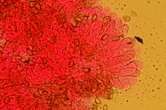 Pseudosperma squamatum