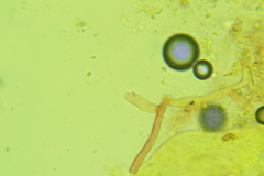 Botryobasidium