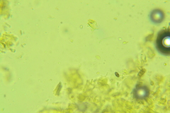 Botryobasidium