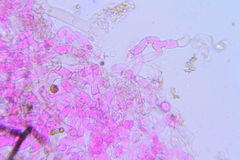 Botryobasidium