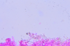 Botryobasidium
