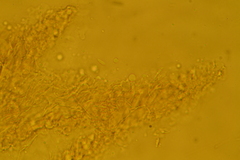 Porotheleaceae
