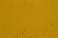 Porotheleaceae