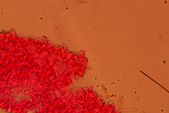 Porotheleaceae