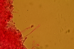Porotheleaceae