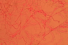 Resupinatus striatulus