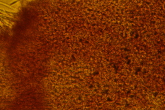 Trichopeziza