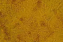 Trichopeziza