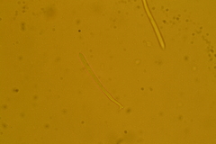 Trichopeziza