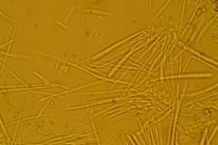 Trichopeziza