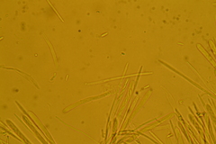 Trichopeziza
