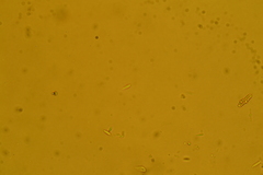 Trichopeziza