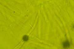 Coccomyces tumidus