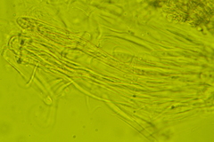 Coccomyces tumidus