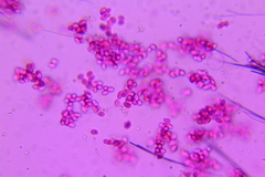 Marasmius nigrodiscus